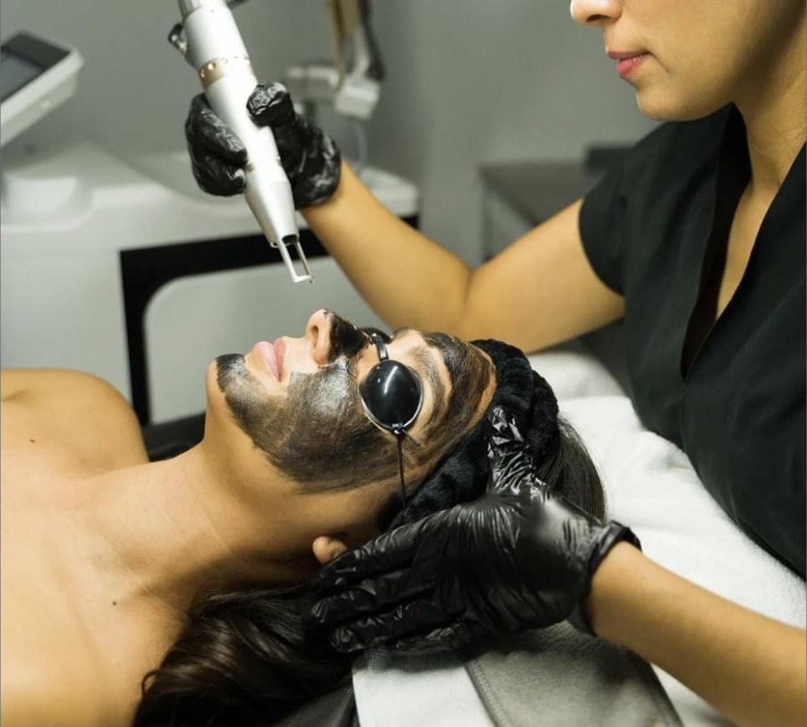 Carbon Peel (Black Doll Laser)