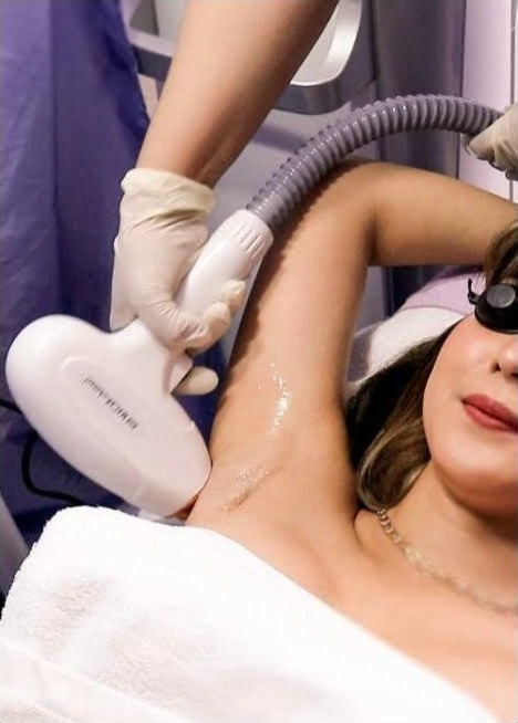 JSJ QuadWave Laser Hair Removal