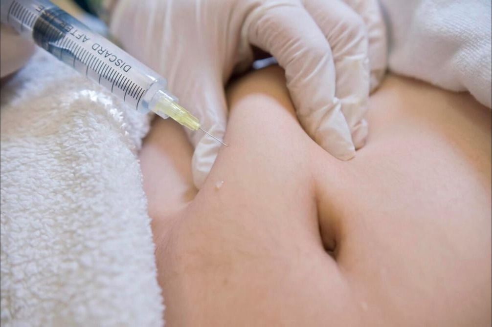 Mesolipo Injection