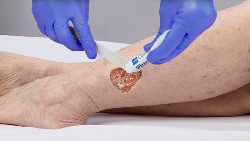 Wound Debridement and Management